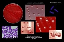 listeria